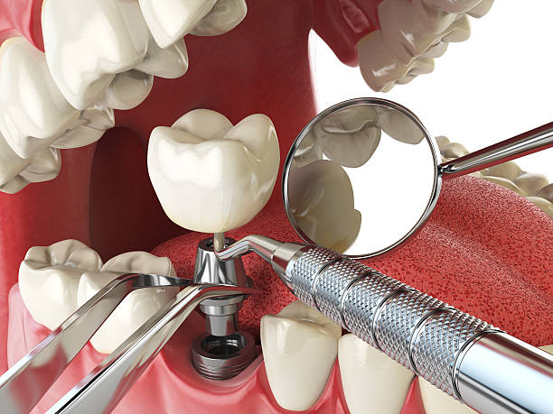 Best Emergency Root Canal Treatment in Avenue B And C, AZ